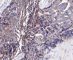 LYPLA1 Antibody in Immunohistochemistry (Paraffin) (IHC (P))