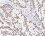 HSF2 Antibody in Immunohistochemistry (Paraffin) (IHC (P))