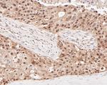 HSF2 Antibody in Immunohistochemistry (Paraffin) (IHC (P))