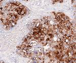 GCDFP-15 Antibody in Immunohistochemistry (Paraffin) (IHC (P))