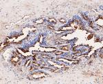 GCDFP-15 Antibody in Immunohistochemistry (Paraffin) (IHC (P))