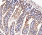 RSK1 Antibody in Immunohistochemistry (Paraffin) (IHC (P))