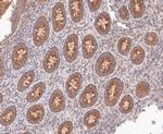 RSK1 Antibody in Immunohistochemistry (Paraffin) (IHC (P))