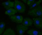 APRIL Antibody in Immunocytochemistry (ICC/IF)