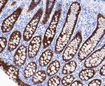 A33 Antibody in Immunohistochemistry (Paraffin) (IHC (P))