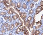 A33 Antibody in Immunohistochemistry (Paraffin) (IHC (P))