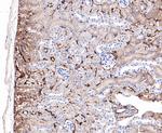 ABAT Antibody in Immunohistochemistry (Paraffin) (IHC (P))