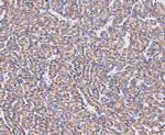 ABAT Antibody in Immunohistochemistry (Paraffin) (IHC (P))