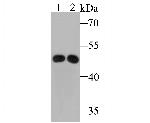 ABAT Antibody in Western Blot (WB)