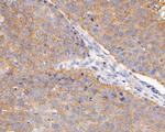 BCL2L12 Antibody in Immunohistochemistry (Paraffin) (IHC (P))