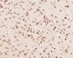 Lamin A/C Antibody in Immunohistochemistry (Paraffin) (IHC (P))