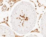 Lamin A/C Antibody in Immunohistochemistry (Paraffin) (IHC (P))