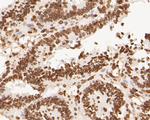 Lamin A/C Antibody in Immunohistochemistry (Paraffin) (IHC (P))