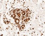 Lamin A/C Antibody in Immunohistochemistry (Paraffin) (IHC (P))