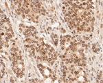 Lamin A/C Antibody in Immunohistochemistry (Paraffin) (IHC (P))