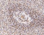 LTA4H Antibody in Immunohistochemistry (Paraffin) (IHC (P))