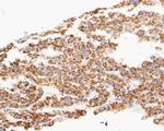 TIMM50 Antibody in Immunohistochemistry (Paraffin) (IHC (P))