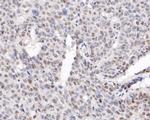 WAPL Antibody in Immunohistochemistry (Paraffin) (IHC (P))