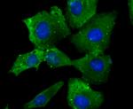 SCN9A Antibody in Immunocytochemistry (ICC/IF)