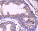 UAP1 Antibody in Immunohistochemistry (Paraffin) (IHC (P))