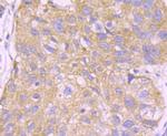 UAP1 Antibody in Immunohistochemistry (Paraffin) (IHC (P))