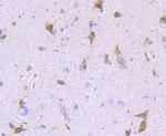 LNP Antibody in Immunohistochemistry (Paraffin) (IHC (P))