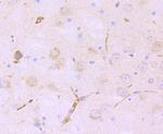 LNP Antibody in Immunohistochemistry (Paraffin) (IHC (P))