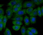 PI3K p85 alpha Antibody in Immunocytochemistry (ICC/IF)