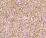 PI3K p85 alpha Antibody in Immunohistochemistry (Paraffin) (IHC (P))