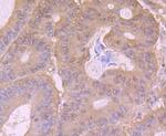 PI3K p85 alpha Antibody in Immunohistochemistry (Paraffin) (IHC (P))