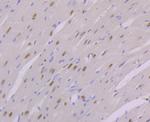 NFIB Antibody in Immunohistochemistry (Paraffin) (IHC (P))