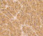 UGP2 Antibody in Immunohistochemistry (Paraffin) (IHC (P))