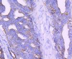 AMACR Antibody in Immunohistochemistry (Paraffin) (IHC (P))