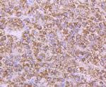 AMACR Antibody in Immunohistochemistry (Paraffin) (IHC (P))