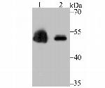 ZSCAN4 Antibody in Western Blot (WB)