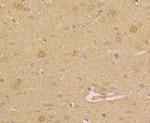 PGP9.5 Antibody in Immunohistochemistry (Paraffin) (IHC (P))