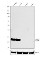 PGP9.5 Antibody in Western Blot (WB)