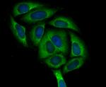 ASS1 Antibody in Immunocytochemistry (ICC/IF)