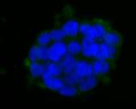 HLA-ABC Antibody in Immunocytochemistry (ICC/IF)