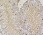 HLA-ABC Antibody in Immunohistochemistry (Paraffin) (IHC (P))