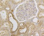 HLA-ABC Antibody in Immunohistochemistry (Paraffin) (IHC (P))