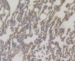 DAPK1 Antibody in Immunohistochemistry (Paraffin) (IHC (P))