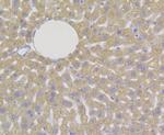 DAPK1 Antibody in Immunohistochemistry (Paraffin) (IHC (P))