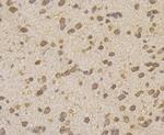 HIP1 Antibody in Immunohistochemistry (Paraffin) (IHC (P))