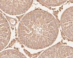 SERPINC1 Antibody in Immunohistochemistry (Paraffin) (IHC (P))