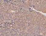 SERPINC1 Antibody in Immunohistochemistry (Paraffin) (IHC (P))