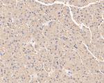 SERPINC1 Antibody in Immunohistochemistry (Paraffin) (IHC (P))