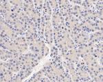 SERPINC1 Antibody in Immunohistochemistry (Paraffin) (IHC (P))