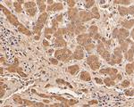 SERPINC1 Antibody in Immunohistochemistry (Paraffin) (IHC (P))