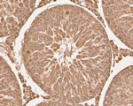 SERPINC1 Antibody in Immunohistochemistry (Paraffin) (IHC (P))